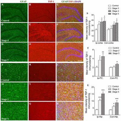 A Purinergic P2 Receptor Family-Mediated Increase in Thrombospondin-1 Bolsters Synaptic Density and Epileptic Seizure Activity in the Amygdala-Kindling Rat Model